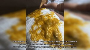 Зеленый стул со слизью у детей