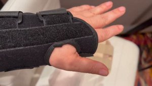 Вместо гипса ОРТЕЗ. Как его выбрать?