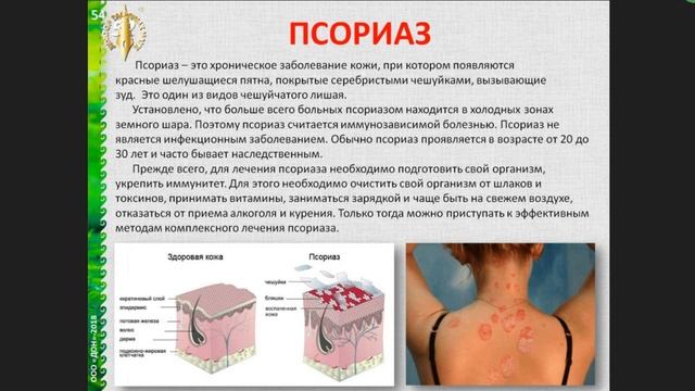 Вебинар фирмы Дон "Чудеса из тюбика" смотреть онлайн