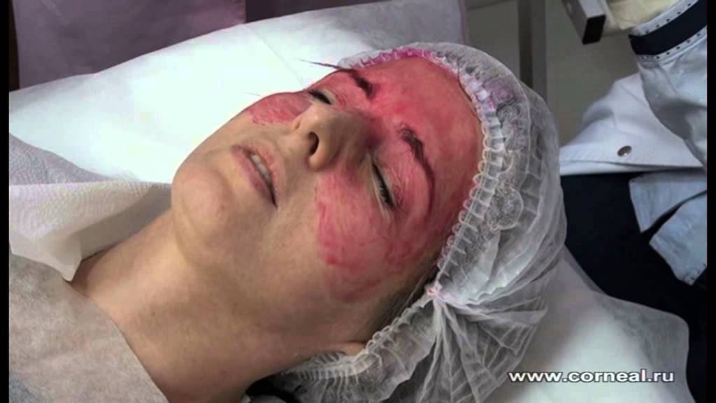 Зачем вообще нужен нейтрализатор?