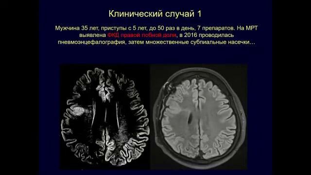 Лекция 