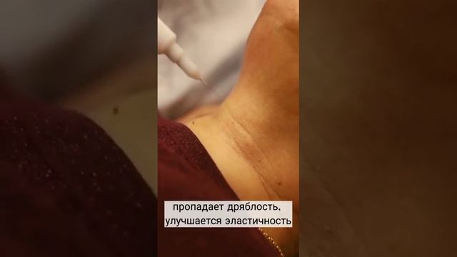 Холодная плазма и возрастные изменения.. Сургут, ☎️8 929 247 84 49