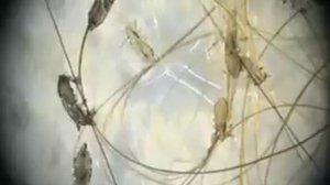 Принцип действия средства против вшей НЮДА