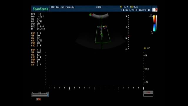 Введение в допплерографию с демонстрацией на пациенте смотреть онлайн