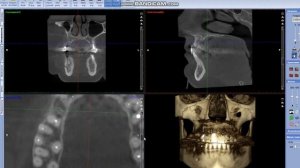 Всё, что вы хотели знать об излучении в стоматологии. Что такое 3Д компьютерная томография и зачем?