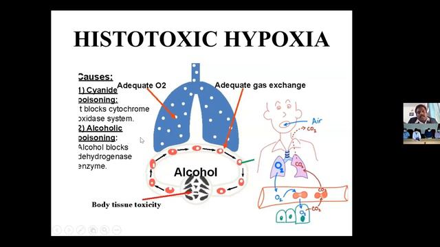 ANAESTHESIOLOGY Webinar "Hypoxia and Oxygen Therapy" held online on 31.07.2021 смотреть онлайн