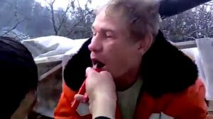 Вырвали зуб плоскогубцами