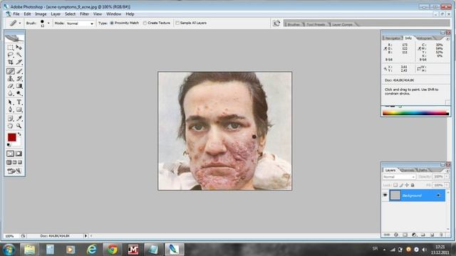 Photoshop CS2™-How to remove pimples or acne (Tutorial смотреть онлайн