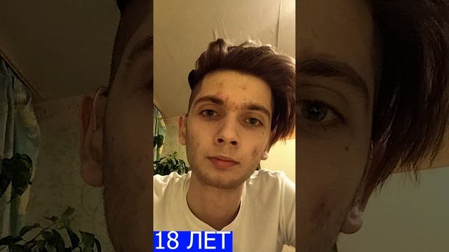 Как я менялся с 16 до 19 лет? / борода / миноксидил / старение