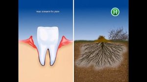 Paradontax зубна паста реклама (Парадонтакс) - Для тих, хто помічає кров під час чищення зубів