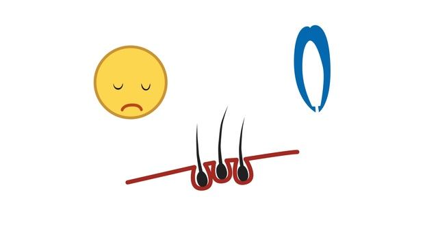 Ролик для Эпиляшки. Вологда смотреть онлайн