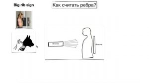 Как считать ребра на рентгенограмме? БОКОВАЯ ПРОЕКЦИЯ | Рентгенология