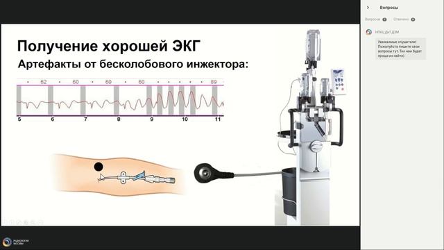 КТ-коронарография: инструкция по сбору данных