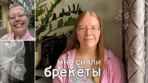 мне сняли брекеты  полтора года в брекетах / результат