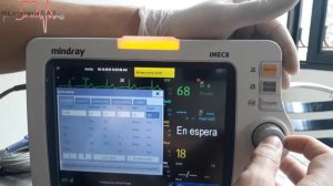 FUNCIONAMIENTO ECG MONITOR IMEC 8