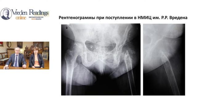 Сложные случаи перипротезной инфекции- особенности хирургического лечения.