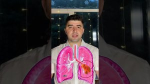 EVALI болезнь вейперов