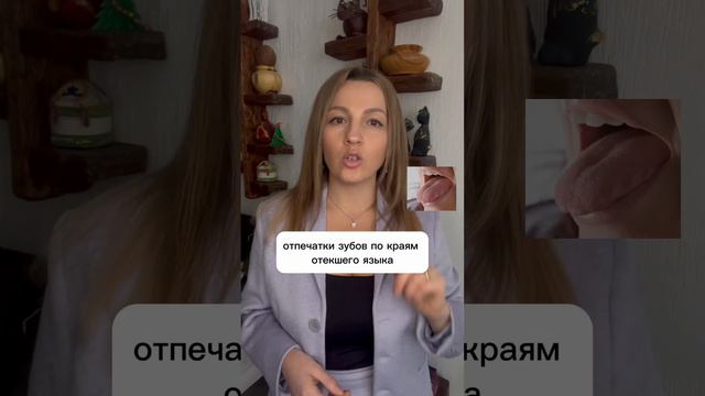 ⁉️А вы часто заглядываете в свою ротовую полость? В каком состоянии находится ваш язык?#нутрициолог смотреть онлайн