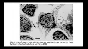 Соединительные ткани со специальными свойствами  Ретикулярная ткань