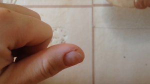 SOS-трещины на коже рук. Средство супер бюджет!