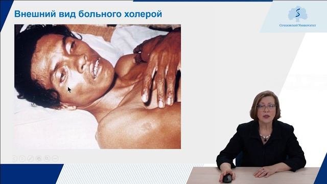 Холера