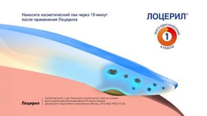Лоцерил. Озвучка рекламного ролика. Диктор Виктория. Заказать озвучку рекламы