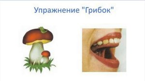 Артикуляционное упражнение Грибок. Упражнение Грибок артикуляционная гимнастика.