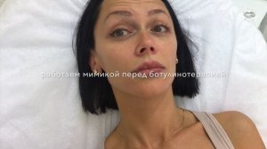 Губы на 2ой день после увеличения