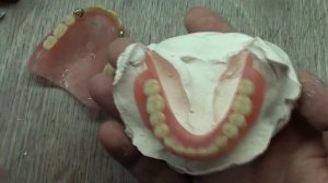 Нижний зубной протез с ушами