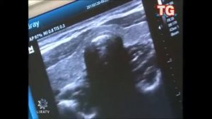 Conferenza e prevenzione al Severi