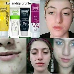 Эрсаг - крема с лечебным эффектом!.mp4