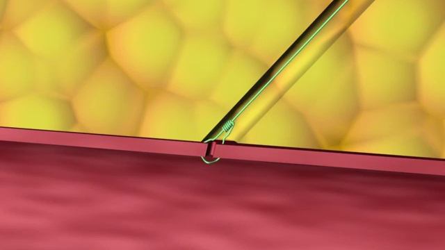 Suturing Device