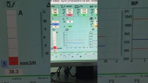 Измерение BIP насос-форсунки VAG на EPS 815+CAM847