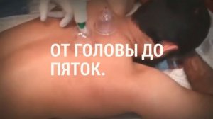 Что такое Хиджама?