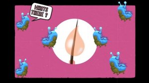 Как образуются прыщи ?