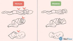 Как лучше спать с подушкой или без?