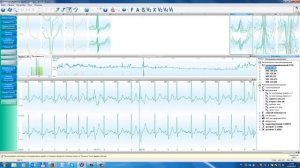 Result3. Разбор морфологии QRS, страница «Оценка морфологии QRS-комплексов».