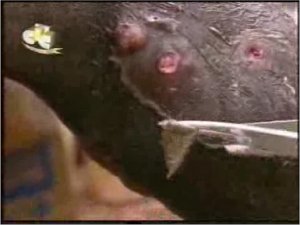 Паразиты в организме человека-РИШТА