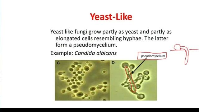 NUS1102 2023 02 09 Unit 5 Medical Mycology part 1 смотреть онлайн