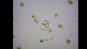 озёрная вода под микроскопом