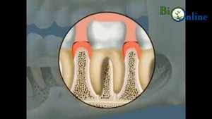 Тіс түрлері, құрылысы және қызметі