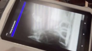 The Quickest Handheld X-Ray Scanner.