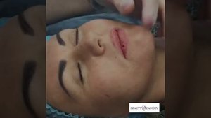 Обучение увеличению губ Hyaluron pen. Гиалурон пен