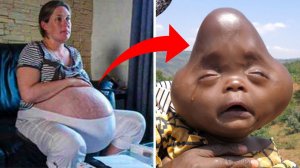 Шокирующие Беременности, Которые Потрясли Мир