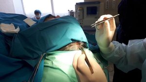 Хирургическое удаление доброкачественных новообразований