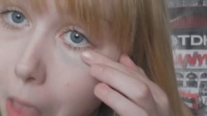 КАК СВЕСТИ СИНЯК под глазом?