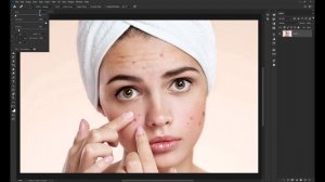 How to Remove Pimples in Adobe Photoshop 2023 (Fast Tutorial)