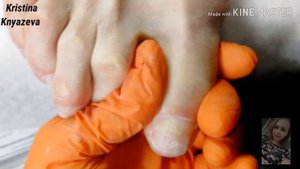 Как приподнять ОЧЕНЬ ПРИЛИПШУЮ КУТИКУЛУ? ?/педикюр/аппаратная обработка стоп/сложные ножки