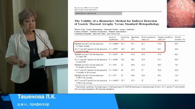 Ташенова Л.К. Хеликобактериозы: есть ли свет в конце тоннеля? смотреть онлайн