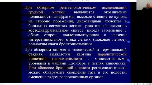 Перитонит